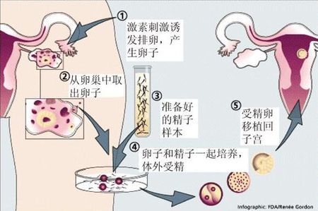 拉拉供卵代孕中心